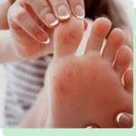 Surgery To Fix Flat Elizabeth