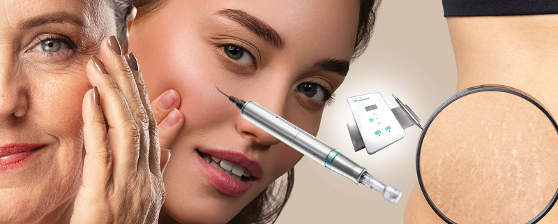 Effective Skin Treatments with Microneedling in Surrey: ext_6838938 — LiveJournal