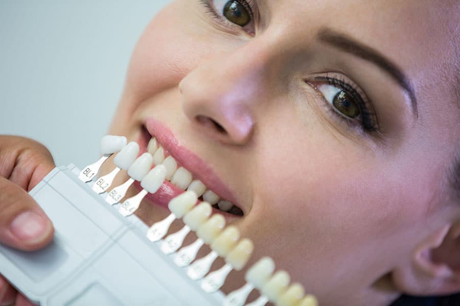 Steps to Getting Dental Veneers: What the Procedure Involves – BDnews55.com
