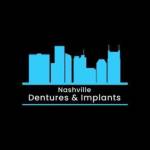Nashville Dentures Implants