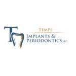 Tempe Periodontist
