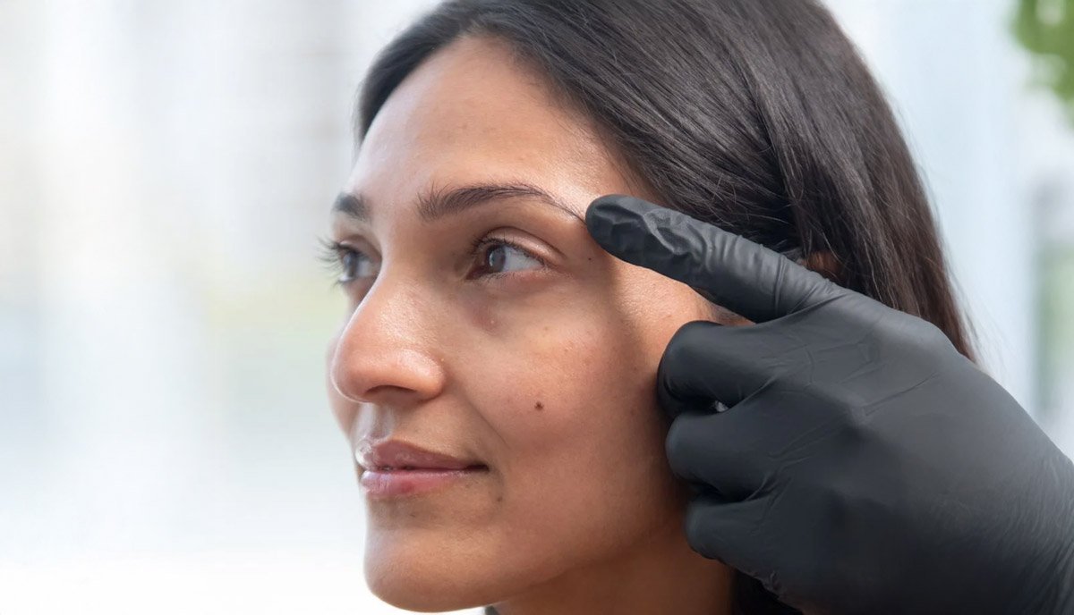 Dark Circles - Maya Medi Spa