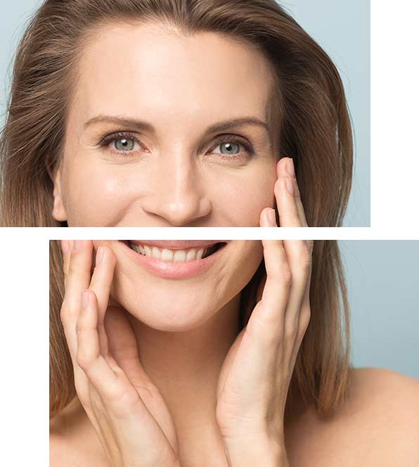 Skin Tightening Laser Laser| Rf Skin Tightening