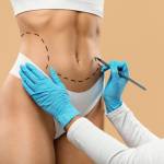 Liposuction in Riyadh